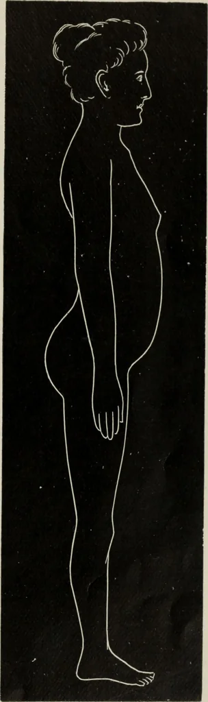 An illustration from The influence of dress in producing the physical decadence of American women : annual address upon obstetrics and gynecology, 1891, leaf 56