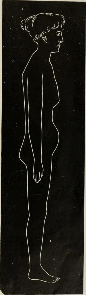 An illustration from The influence of dress in producing the physical decadence of American women : annual address upon obstetrics and gynecology, 1891, leaf 60