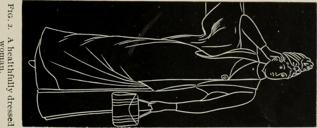 An illustration from The influence of dress in producing the physical decadence of American women : annual address upon obstetrics and gynecology, 1891, leaf 64