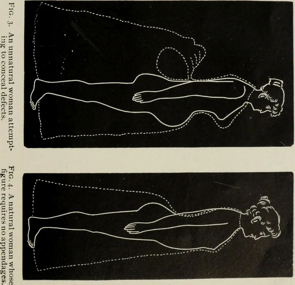 An illustration from The influence of dress in producing the physical decadence of American women : annual address upon obstetrics and gynecology, 1891, leaf 64
