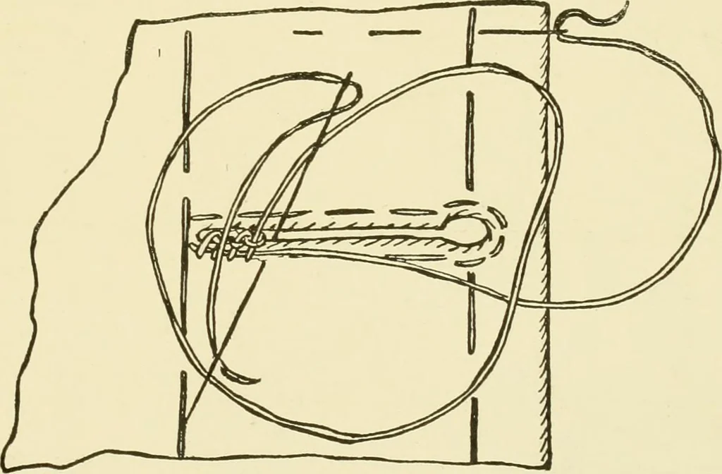 An illustration from Instruction book ... to be used only as a guide and partial study in the expert course in dressmaking, 1915, leaf 30
