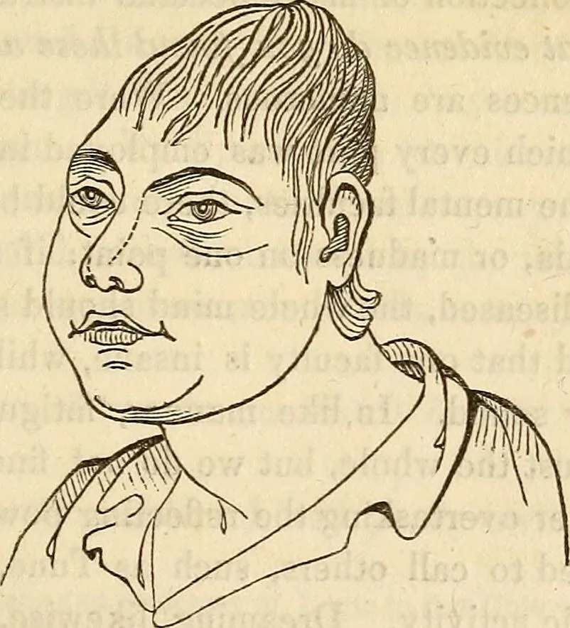 An illustration from An introduction to phrenology, 1837, leaf 30