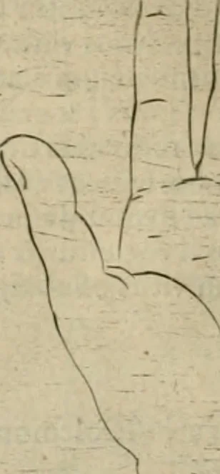 An illustration from Io. Batis. Portae Neap. De humana physiognomia li. VI : in quibus docetur quom[odo] animi propentes naturalibus remediis compesci possint, 1602, leaf 137