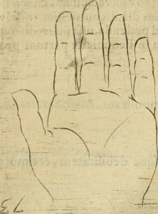An illustration from Io. Batis. Portae Neap. De humana physiognomia li. VI : in quibus docetur quom[odo] animi propentes naturalibus remediis compesci possint, 1602, leaf 140