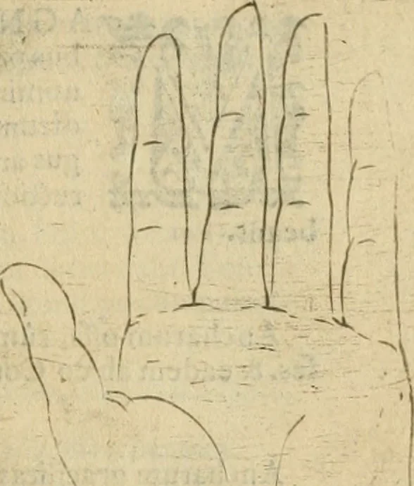 An illustration from Io. Batis. Portae Neap. De humana physiognomia li. VI : in quibus docetur quom[odo] animi propentes naturalibus remediis compesci possint, 1602, leaf 140