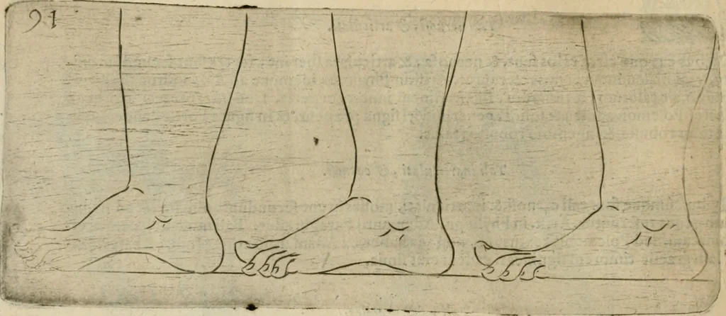 An illustration from Io. Batis. Portae Neap. De humana physiognomia li. VI : in quibus docetur quom[odo] animi propentes naturalibus remediis compesci possint, 1602, leaf 149