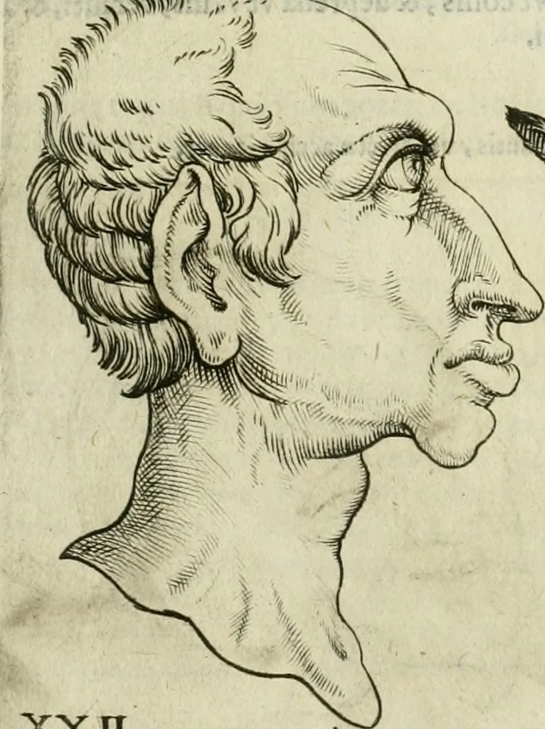 An illustration from Io. Batis. Portae Neap. De humana physiognomia li. VI : in quibus docetur quom[odo] animi propentes naturalibus remediis compesci possint, 1602, leaf 62