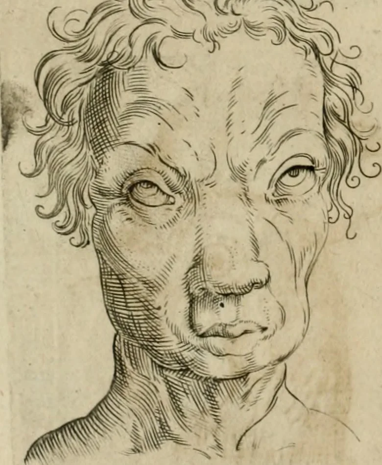 An illustration from Io. Batis. Portae Neap. De humana physiognomia li. VI : in quibus docetur quom[odo] animi propentes naturalibus remediis compesci possint, 1602, leaf 79