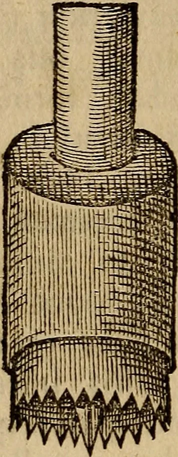 An illustration from Jacobi BerengarI De fractura cranii liber aureus : hactenus desideratus, 1629, leaf 291