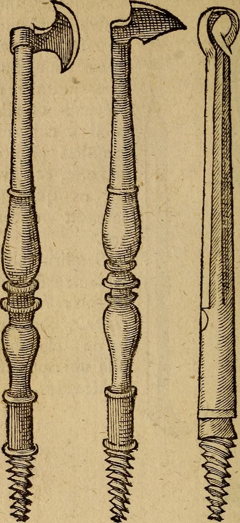 An illustration from Jacobi BerengarI De fractura cranii liber aureus : hactenus desideratus, 1629, leaf 299