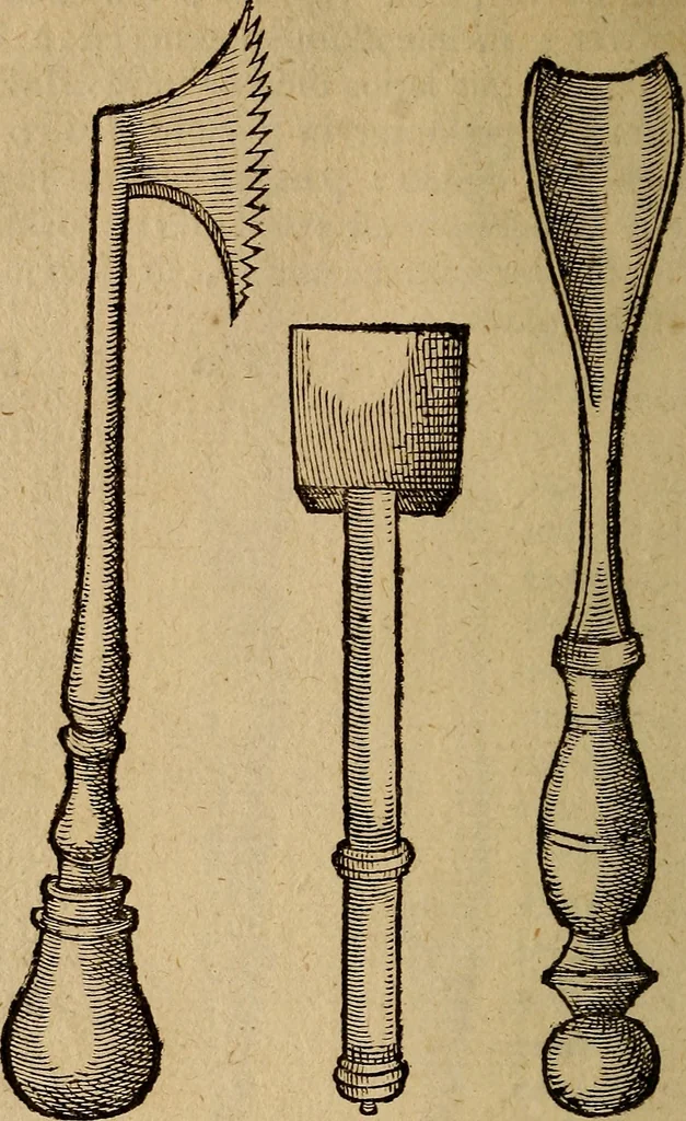 An illustration from Jacobi BerengarI De fractura cranii liber aureus : hactenus desideratus, 1629, leaf 301