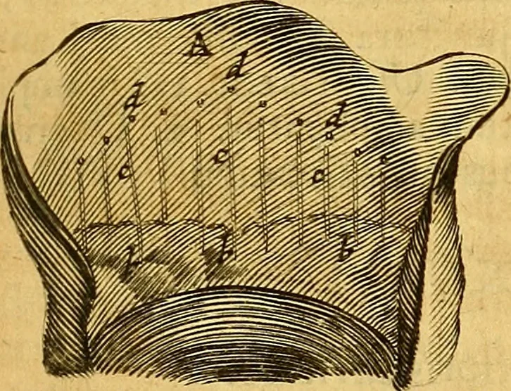 An illustration from Joannis Veslingii, equitus, professoris quondam Patavini, & c., Syntagma anatomicum, commentario atque appendice ex veterum, recentiorum, propriisque, observationibus, 1666, leaf 516