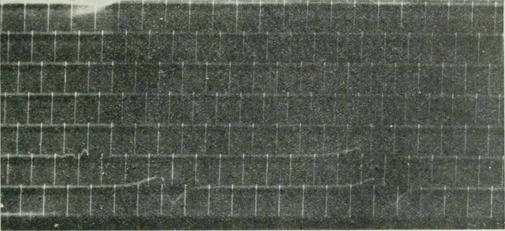 An illustration from Journal - Franklin Institute of the State of Pennsylvania, 1826, leaf 72