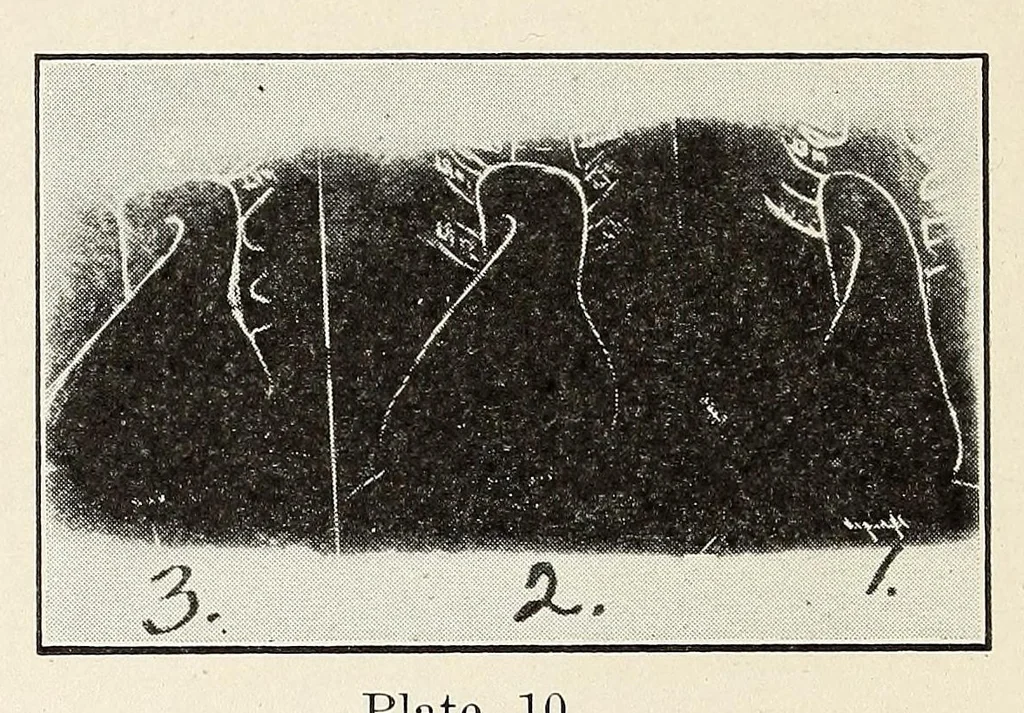 An illustration from The Journal of roentgenology, 1918, leaf 270