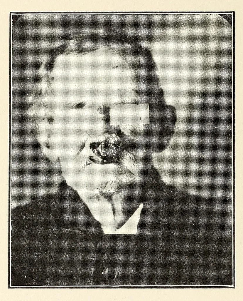 An illustration from The Journal of roentgenology, 1918, leaf 284