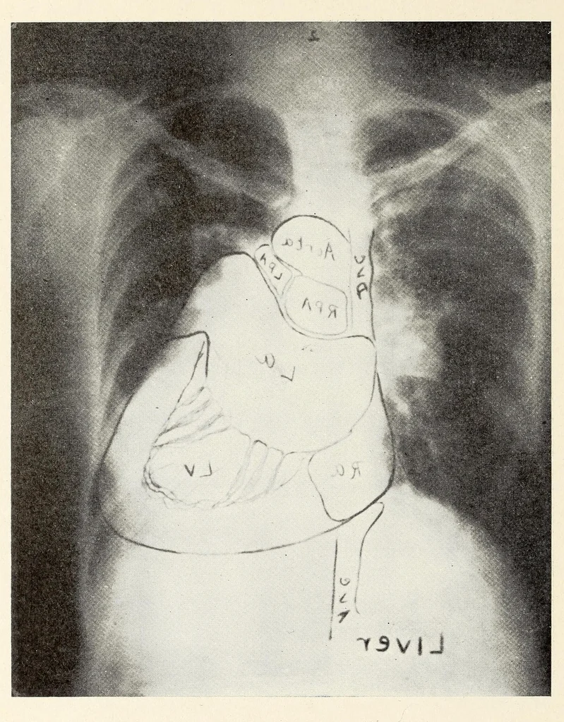 An illustration from The Journal of roentgenology, 1918, leaf 356