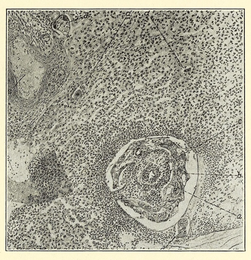 An illustration from The Journal of roentgenology, 1918, leaf 429