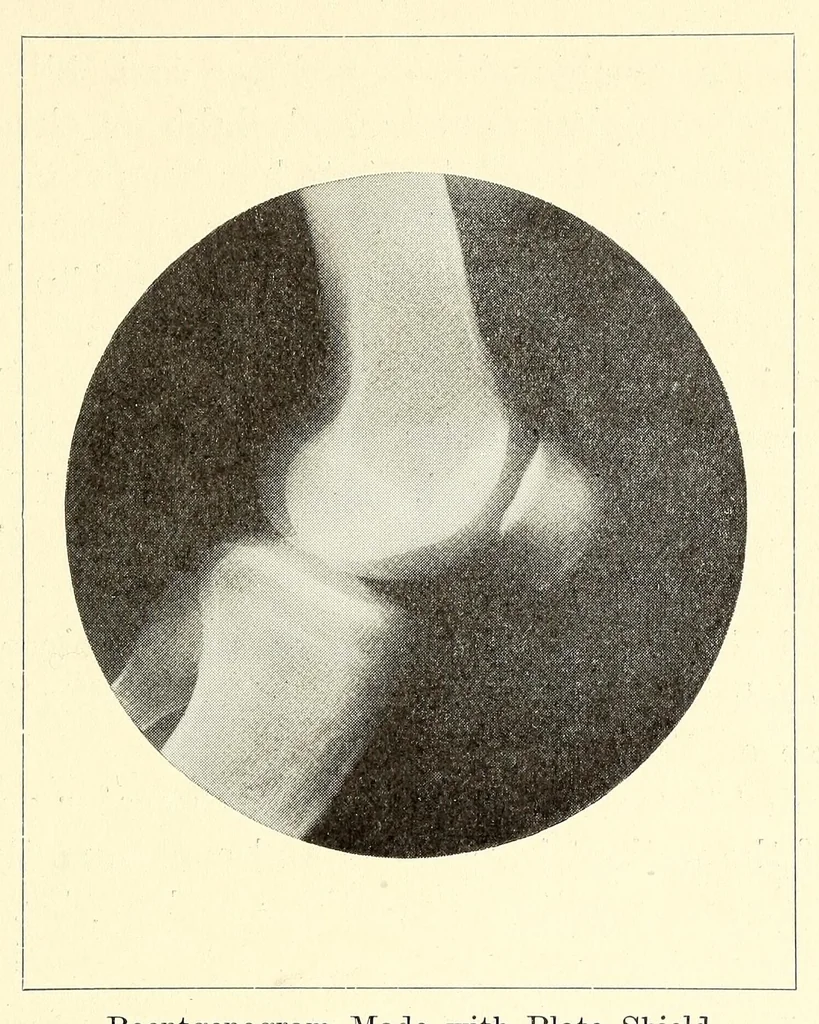 An illustration from The Journal of roentgenology, 1918, leaf 449