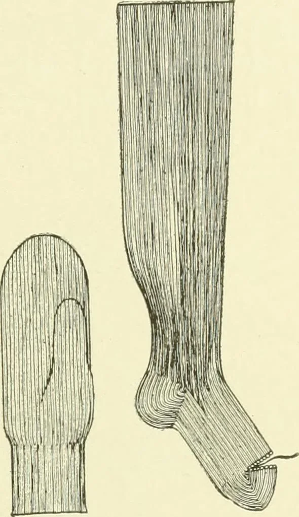 An illustration from Knitting; a manual of practical instruction in the mechanical details of all types of knitting machinery, their operation, adjustment, and care, 1909, leaf 246