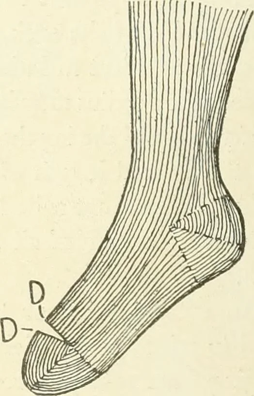 An illustration from Knitting; a manual of practical instruction in the mechanical details of all types of knitting machinery, their operation, adjustment, and care, 1909, leaf 275