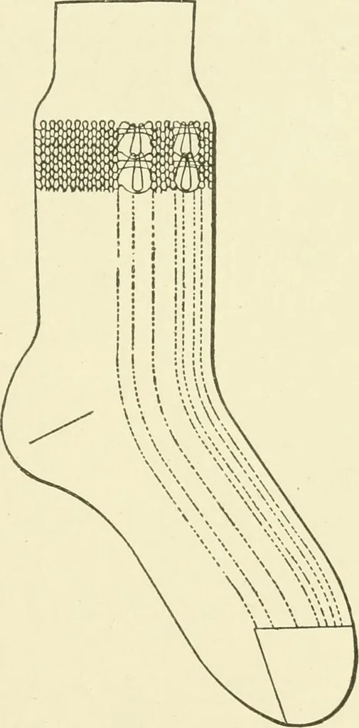 An illustration from Knitting; a manual of practical instruction in the mechanical details of all types of knitting machinery, their operation, adjustment, and care, 1909, leaf 304
