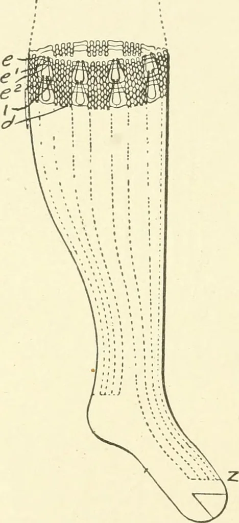 An illustration from Knitting; a manual of practical instruction in the mechanical details of all types of knitting machinery, their operation, adjustment, and care, 1909, leaf 305