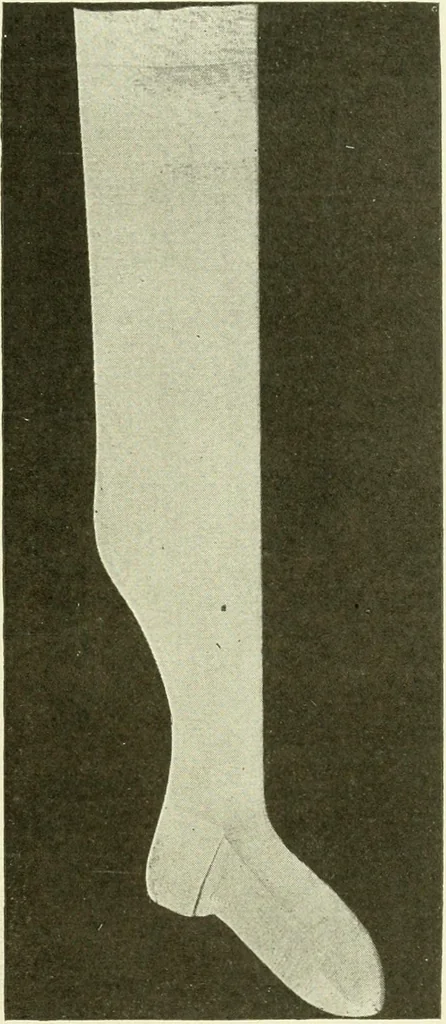An illustration from Knitting; a manual of practical instruction in the mechanical details of all types of knitting machinery, their operation, adjustment, and care, 1909, leaf 324