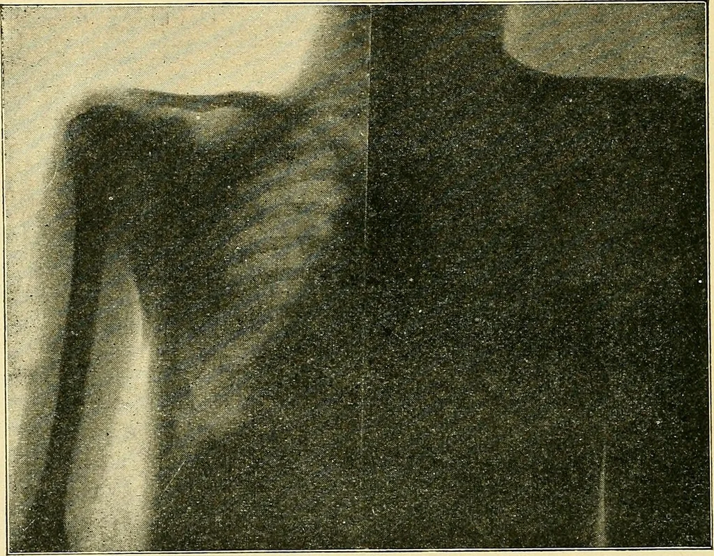 An illustration from Konstruktion, Bau und Betrieb von Funkeninduktoren und deren Anwendung, mit besonderer Berücksichtigung der Röntgenstrahlen-Technik, 1904, leaf 217