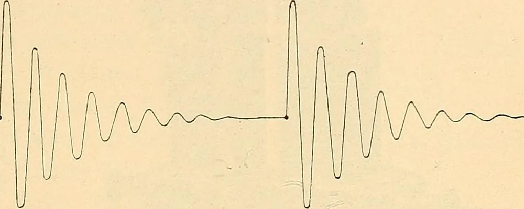 An illustration from Konstruktion, Bau und Betrieb von Funkeninduktoren und deren Anwendung, mit besonderer Berücksichtigung der Röntgenstrahlen-Technik, 1904, leaf 238