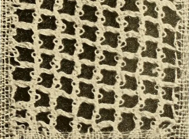 An illustration from A lace guide for makers and collectors; with a bibliography and five-language nomenclature, profusely illus. with halftone plates and key designs, 1920, leaf 106