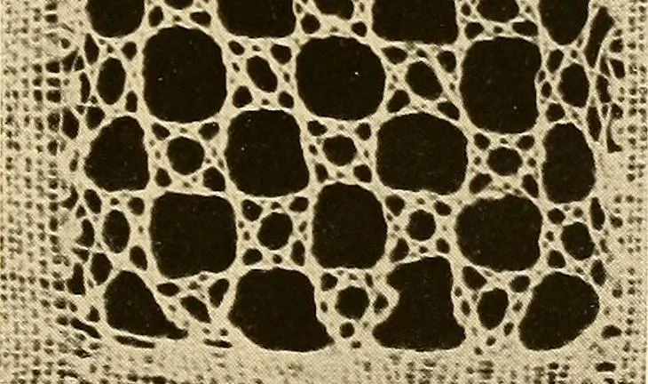 An illustration from A lace guide for makers and collectors; with a bibliography and five-language nomenclature, profusely illus. with halftone plates and key designs, 1920, leaf 98