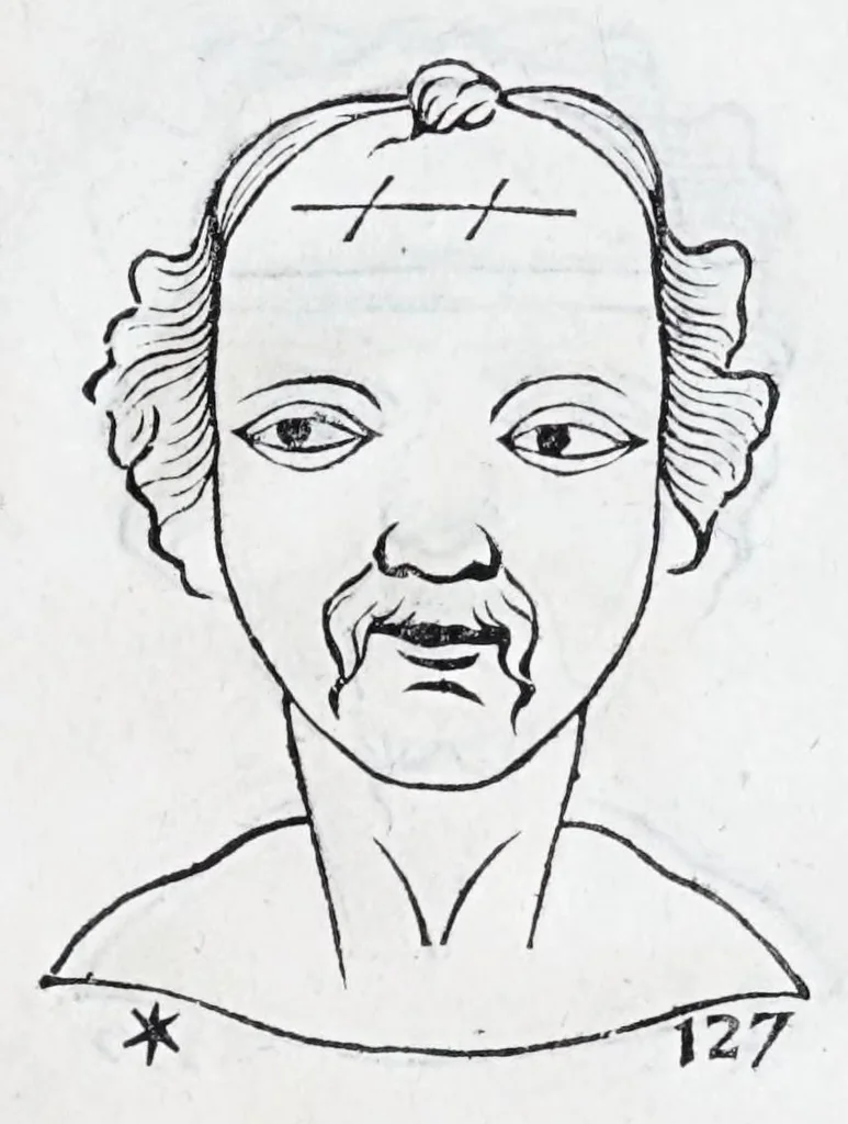 An illustration from La metoposcopie de H. Cardan, medecin milanois : comprise en treize liures, et huit cens figures de la face humaine : a laquelle a esté adjousté, Le traicté des marques naturelles du corps, par Melampus, antien autheur grec : le tout traduit en françois par le sieur C. M. de Laurendiere, docteur en medecine, 1658, leaf 103