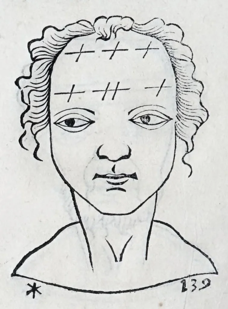 An illustration from La metoposcopie de H. Cardan, medecin milanois : comprise en treize liures, et huit cens figures de la face humaine : a laquelle a esté adjousté, Le traicté des marques naturelles du corps, par Melampus, antien autheur grec : le tout traduit en françois par le sieur C. M. de Laurendiere, docteur en medecine, 1658, leaf 106