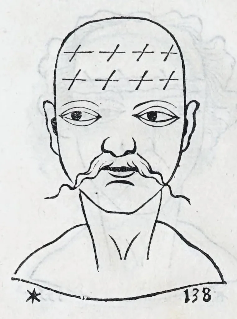 An illustration from La metoposcopie de H. Cardan, medecin milanois : comprise en treize liures, et huit cens figures de la face humaine : a laquelle a esté adjousté, Le traicté des marques naturelles du corps, par Melampus, antien autheur grec : le tout traduit en françois par le sieur C. M. de Laurendiere, docteur en medecine, 1658, leaf 106