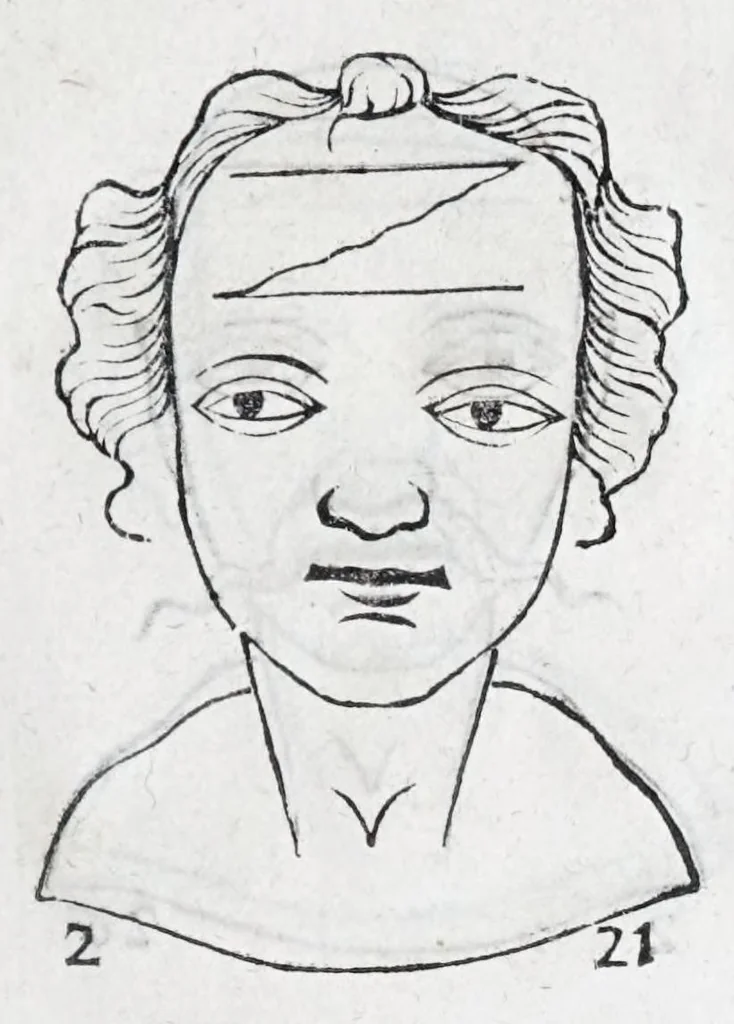 An illustration from La metoposcopie de H. Cardan, medecin milanois : comprise en treize liures, et huit cens figures de la face humaine : a laquelle a esté adjousté, Le traicté des marques naturelles du corps, par Melampus, antien autheur grec : le tout traduit en françois par le sieur C. M. de Laurendiere, docteur en medecine, 1658, leaf 169