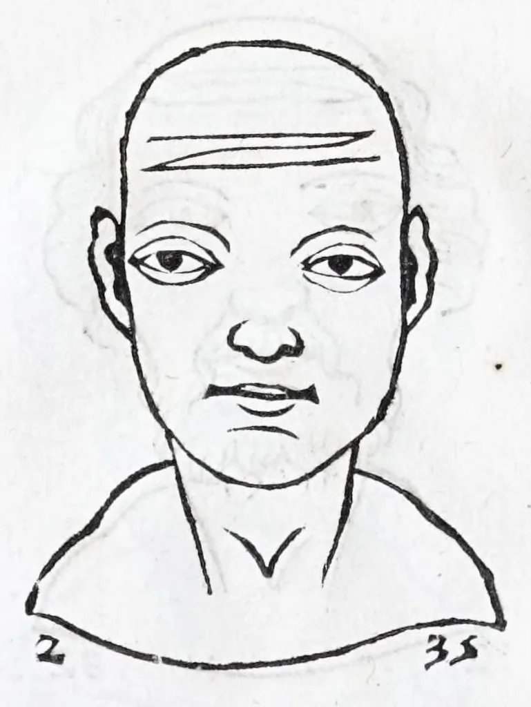 An illustration from La metoposcopie de H. Cardan, medecin milanois : comprise en treize liures, et huit cens figures de la face humaine : a laquelle a esté adjousté, Le traicté des marques naturelles du corps, par Melampus, antien autheur grec : le tout traduit en françois par le sieur C. M. de Laurendiere, docteur en medecine, 1658, leaf 172