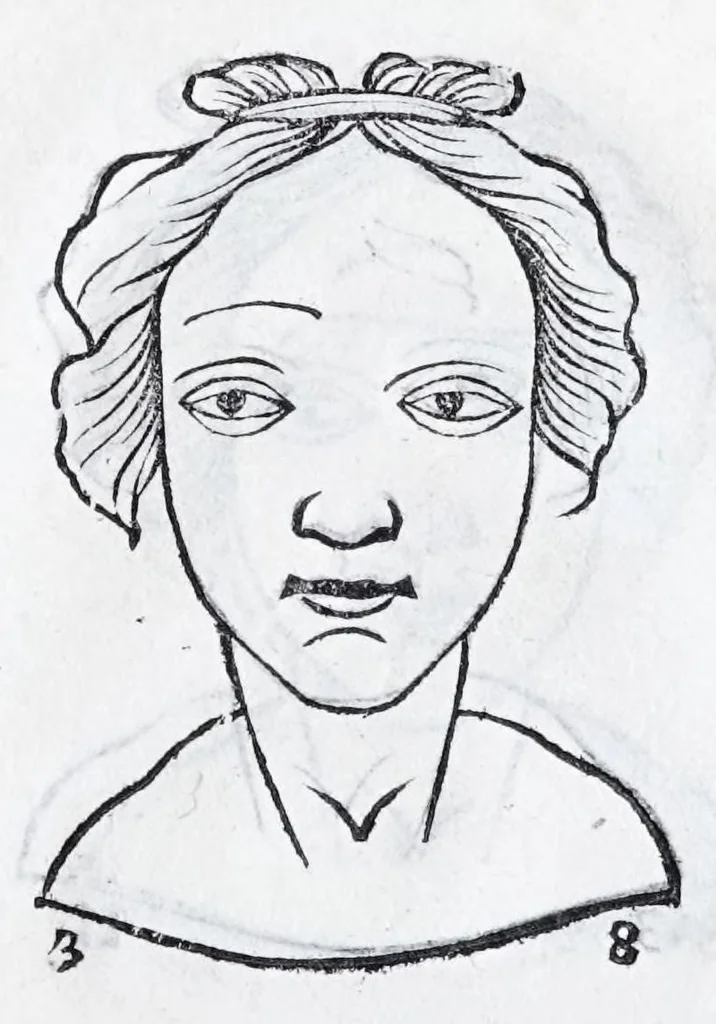 An illustration from La metoposcopie de H. Cardan, medecin milanois : comprise en treize liures, et huit cens figures de la face humaine : a laquelle a esté adjousté, Le traicté des marques naturelles du corps, par Melampus, antien autheur grec : le tout traduit en françois par le sieur C. M. de Laurendiere, docteur en medecine, 1658, leaf 175