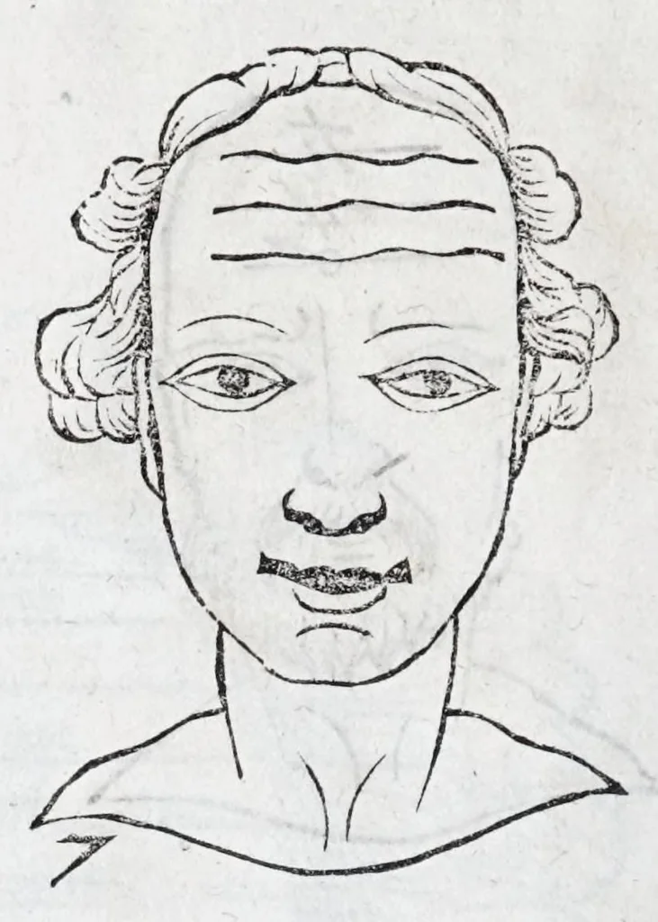 An illustration from La metoposcopie de H. Cardan, medecin milanois : comprise en treize liures, et huit cens figures de la face humaine : a laquelle a esté adjousté, Le traicté des marques naturelles du corps, par Melampus, antien autheur grec : le tout traduit en françois par le sieur C. M. de Laurendiere, docteur en medecine, 1658, leaf 24