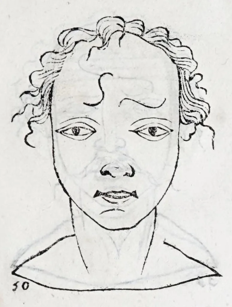 An illustration from La metoposcopie de H. Cardan, medecin milanois : comprise en treize liures, et huit cens figures de la face humaine : a laquelle a esté adjousté, Le traicté des marques naturelles du corps, par Melampus, antien autheur grec : le tout traduit en françois par le sieur C. M. de Laurendiere, docteur en medecine, 1658, leaf 35