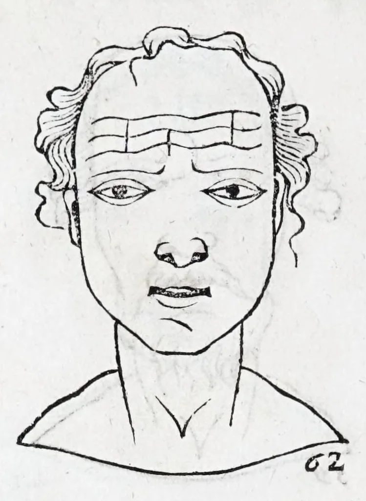 An illustration from La metoposcopie de H. Cardan, medecin milanois : comprise en treize liures, et huit cens figures de la face humaine : a laquelle a esté adjousté, Le traicté des marques naturelles du corps, par Melampus, antien autheur grec : le tout traduit en françois par le sieur C. M. de Laurendiere, docteur en medecine, 1658, leaf 38