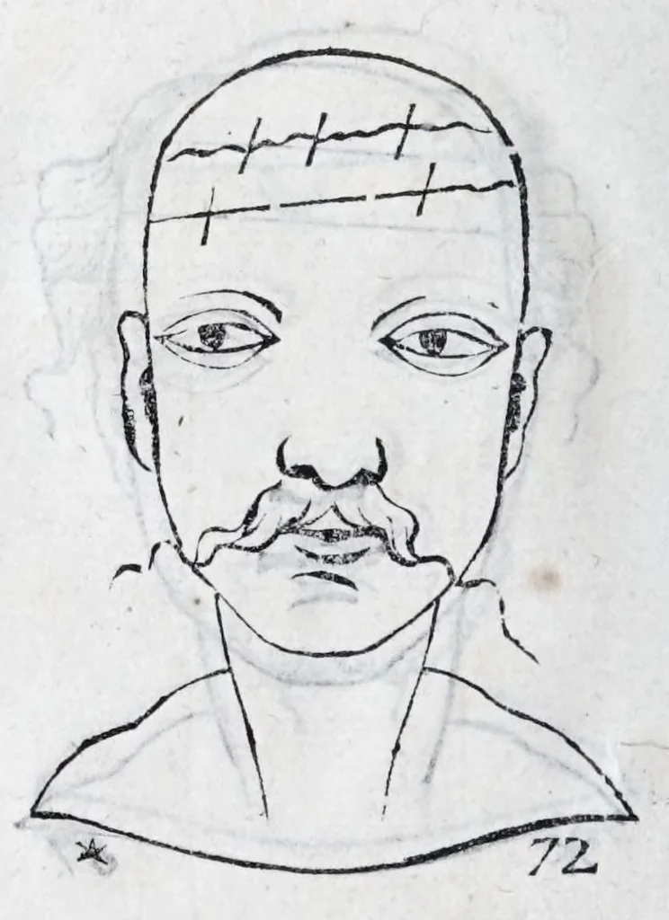 An illustration from La metoposcopie de H. Cardan, medecin milanois : comprise en treize liures, et huit cens figures de la face humaine : a laquelle a esté adjousté, Le traicté des marques naturelles du corps, par Melampus, antien autheur grec : le tout traduit en françois par le sieur C. M. de Laurendiere, docteur en medecine, 1658, leaf 84