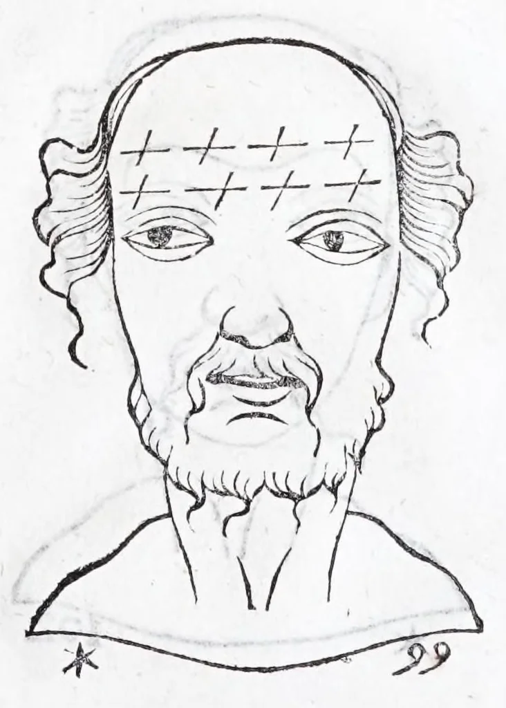 An illustration from La metoposcopie de H. Cardan, medecin milanois : comprise en treize liures, et huit cens figures de la face humaine : a laquelle a esté adjousté, Le traicté des marques naturelles du corps, par Melampus, antien autheur grec : le tout traduit en françois par le sieur C. M. de Laurendiere, docteur en medecine, 1658, leaf 93