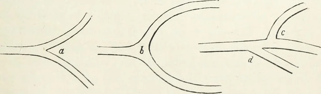An illustration from The landscape gardening and landscape architecture of the late Humphry Repton, esq., being his entire works on these subjects : ...with historical and scientific introduction, a systematic analysis, a biographical notice, notes, and copious alphabetical index, 1840, leaf 246