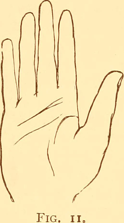 An illustration from The language of the hand, being a concise exposition of the principles and practice of the art of reading the hand, 1899, leaf 110