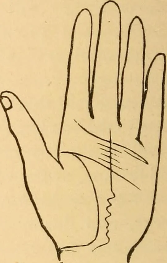 An illustration from The language of the hand, being a concise exposition of the principles and practice of the art of reading the hand, 1899, leaf 119