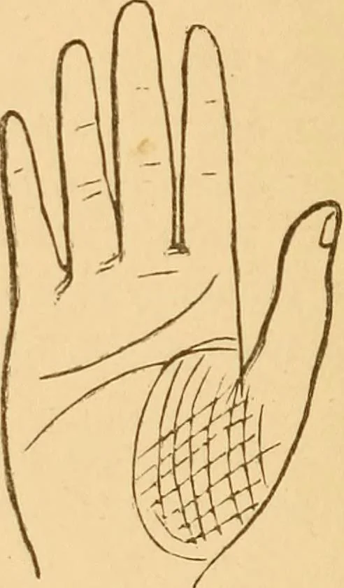 An illustration from The language of the hand, being a concise exposition of the principles and practice of the art of reading the hand, 1899, leaf 157