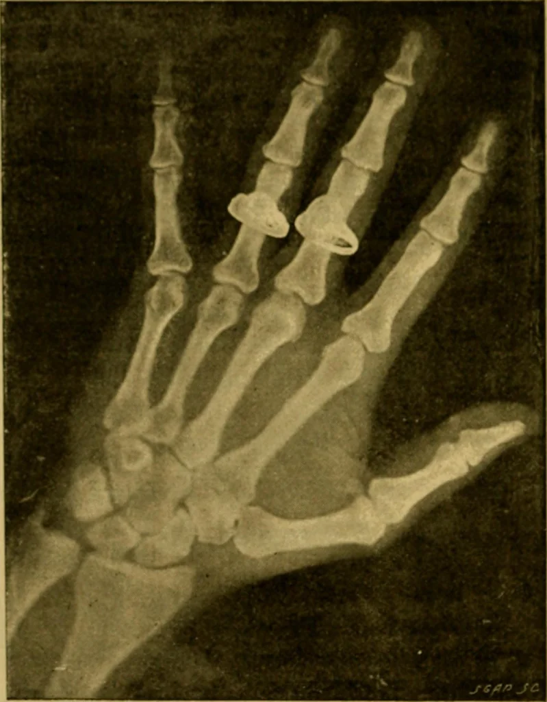 An illustration from La photographie de l'invisible : les rayons X suivi d'un glossaire, 1898, leaf 119