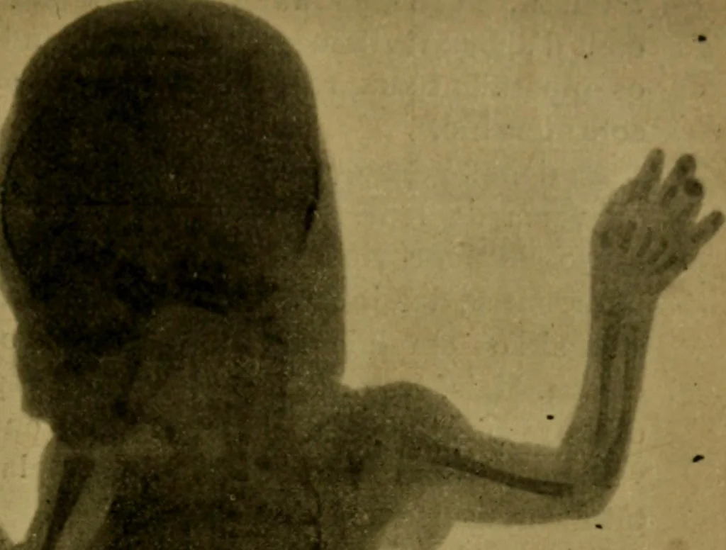 An illustration from La photographie de l'invisible : les rayons X suivi d'un glossaire, 1898, leaf 128