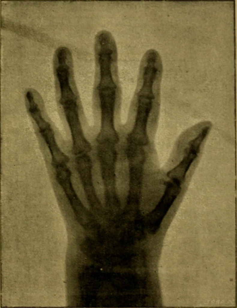An illustration from La photographie de l'invisible : les rayons X suivi d'un glossaire, 1898, leaf 130