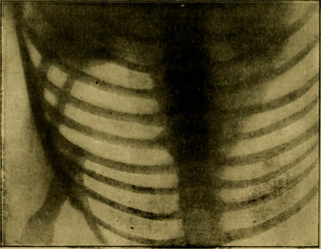An illustration from La photographie de l'invisible : les rayons X suivi d'un glossaire, 1898, leaf 131